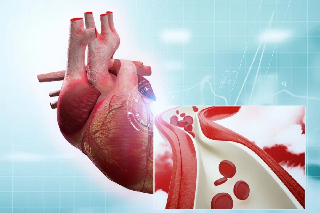 99% 的血栓可能毫无征兆！这 3 个地方痛，就要小心了