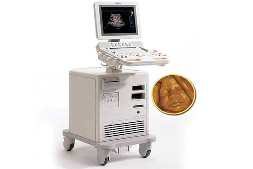 飞利浦四维立体彩超